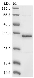 Greater than 85% as determined by SDS-PAGE.Recombinant Mouse Tripeptidyl-Peptidase 2 (TPP2) Protein (His&Myc)