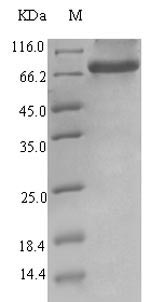 Greater than 90% as determined by SDS-PAGE.Recombinant Human Endogenous Retrovirus Group K Member 6 Env Polyprotein (ERVK-6) Protein (His-SUMO)