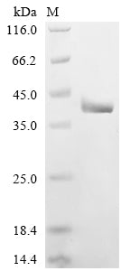 Greater than 90% as determined by SDS-PAGE.Recombinant Human Vacuolar Protein Sorting-Associated Protein 13D (VPS13D) Protein (His)