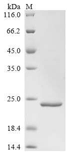 Greater than 90% as determined by SDS-PAGE.Recombinant Legionella Pneumophila Subsp. Pneumophila 50S Ribosomal Protein L7/L12 (RPLL) Protein (His&Myc)
