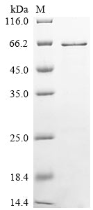 Greater than 85% as determined by SDS-PAGE.Recombinant Mouse Adenomatous Polyposis Coli Protein (APC) Protein (His&Myc)