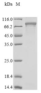 Greater than 85% as determined by SDS-PAGE.Recombinant Human Protein Cbfa2T1 (RUNX1T1) Protein (His&Myc)