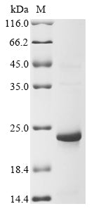 Greater than 85% as determined by SDS-PAGE.Recombinant Xenopus Tropicalis 60S Ribosomal Protein L36 (RPL36) Protein (His&Myc)