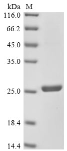 Greater than 90% as determined by SDS-PAGE.Recombinant Mouse Collagen alpha-1 (COL12A1) Protein (His)