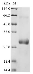 Greater than 85% as determined by SDS-PAGE.Recombinant Mouse Protein Pml (PML) Protein (His&Myc)