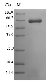 Greater than 90% as determined by SDS-PAGE.Recombinant Mouse Muscle, Skeletal Receptor Tyrosine-Protein Kinase (MUSK) Protein (His-SUMO&Myc)