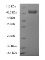 Greater than 90% as determined by SDS-PAGE.Recombinant Human Autophagy-Related Protein 16-1 (ATG16L1) Protein (His-SUMO)