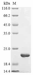 Greater than 90% as determined by SDS-PAGE.Recombinant Mouse Fanconi-Associated Nuclease 1 (FAN1) Protein (His&Myc)