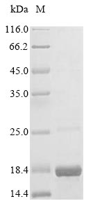 Greater than 90% as determined by SDS-PAGE.Recombinant Human Sh3 And Px Domain-Containing Protein 2A (SH3PXD2A) Protein (His&Myc)
