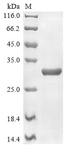 Greater than 85% as determined by SDS-PAGE.Recombinant Mouse Transcriptional Enhancer Factor Tef-3 (TEAD4) Protein (His&Myc)