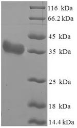 Greater than 90% as determined by SDS-PAGE.Recombinant Arachis Hypogaea Arachin Ahy-3 Protein (His-SUMO)