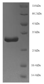 Greater than 90% as determined by SDS-PAGE.Recombinant Staphylococcus Aureus Holo-[Acyl-Carrier-Protein] Synthase (ACPS) Protein (His-SUMO)