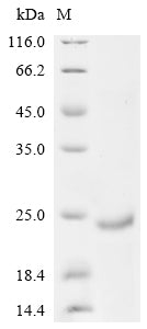 Greater than 85% as determined by SDS-PAGE.Recombinant Human Alk And Ltk Ligand 2 (ALKAL2) Protein (His&Myc)