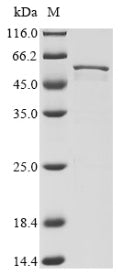 Greater than 85% as determined by SDS-PAGE.Recombinant Human Coronavirus Nl63 Nucleoprotein (N) Protein (His)