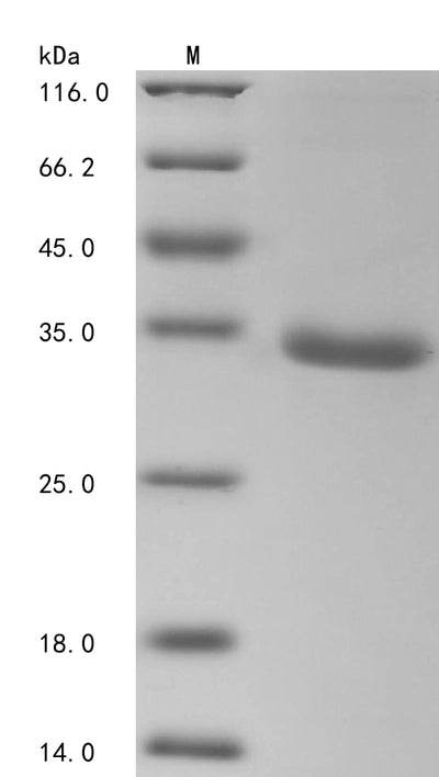 Greater than 90% as determined by SDS-PAGE.Recombinant Human Tripartite Motif-Containing Protein 72 (TRIM72) Protein (His&Myc)