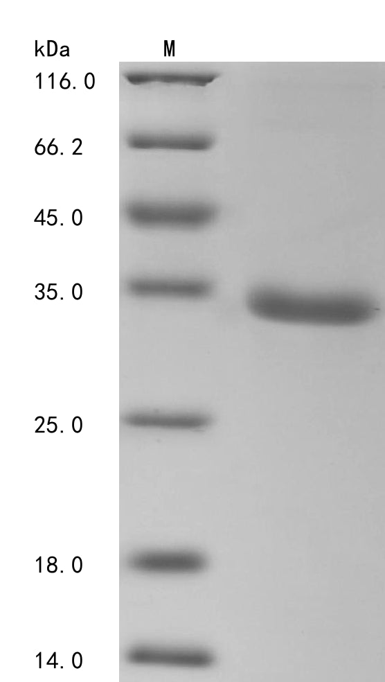Greater than 90% as determined by SDS-PAGE.Recombinant Human Tripartite Motif-Containing Protein 72 (TRIM72) Protein (His&Myc)