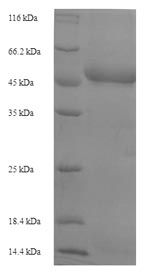 Greater than 90% as determined by SDS-PAGE.Recombinant Plasmodium Falciparum Plasmepsin I (PF14_0076) Protein (His-SUMO)
