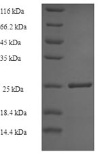 Greater than 85% as determined by SDS-PAGE.Recombinant Human Tubulinyl-Tyr Carboxypeptidase 1 (VASH1) Protein (His)