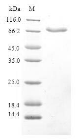 Greater than 90% as determined by SDS-PAGE.Recombinant Human Ribonucleoside-Diphosphate Reductase Subunit M2 B (RRM2B) Protein (GST)