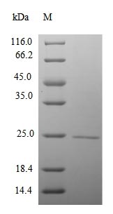 Greater than 90% as determined by SDS-PAGE.Recombinant Mouse Rna Polymerase Ii Subunit A C-Terminal Domain Phosphatase (CTDP1) Protein (His&Myc)