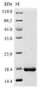 Greater than 90% as determined by SDS-PAGE.Recombinant Human Protein Il-40 (C17ORF99) Protein (His&Myc)