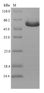 Greater than 90% as determined by SDS-PAGE.Recombinant Human Gdnf Family Receptor Alpha-Like (GFRAL) Protein (His-SUMO)