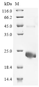 Greater than 85% as determined by SDS-PAGE.Recombinant Human R-Spondin-2 (RSPO2) Protein (His)
