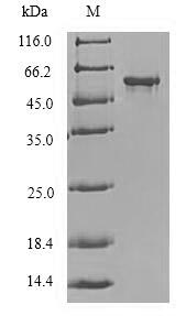 Greater than 90% as determined by SDS-PAGE.Recombinant Human Protein Delta Homolog 2 (DLK2) Protein (GST)
