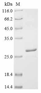 Greater than 90% as determined by SDS-PAGE.Recombinant Human Metapneumovirus Fusion Glycoprotein F0 (F) Protein (His-SUMO)
