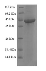 Greater than 90% as determined by SDS-PAGE.Recombinant Human Sesquipedalian-2 (FAM109B) Protein (His-SUMO)