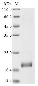 Greater than 90% as determined by SDS-PAGE.Recombinant Human Surfactant-Associated Protein 2 (SFTA2) Protein (His-SUMO)