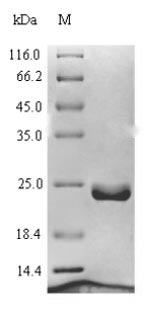 Greater than 90% as determined by SDS-PAGE.Recombinant Human Ragulator Complex Protein Lamtor1 (LAMTOR1) Protein (His)