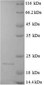 Greater than 90% as determined by SDS-PAGE.Recombinant Arachis Hypogaea Conglutin-7 Protein (His)