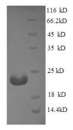 Greater than 90% as determined by SDS-PAGE.Recombinant Human Angiopoietin-Like Protein 8 (ANGPTL8) Protein (His)