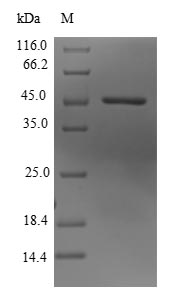 Greater than 90% as determined by SDS-PAGE.Recombinant Human Lysine-Specific Demethylase 3B (KDM3B) Protein (His-SUMO&Myc)