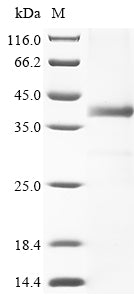 Greater than 85% as determined by SDS-PAGE.Recombinant Human Dna Cross-Link Repair 1A Protein (DCLRE1A) Protein (His)