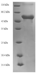 Greater than 90% as determined by SDS-PAGE.Recombinant Zaire Ebolavirus Matrix Protein Vp40 (VP40) Protein (His-SUMO)