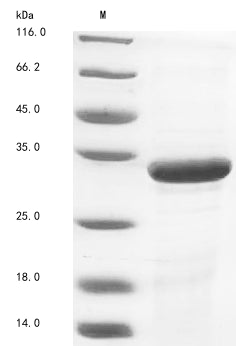 Greater than 85% as determined by SDS-PAGE.Recombinant Zaire Ebolavirus Matrix Protein Vp40 (VP40) Protein (His)