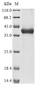 Greater than 85% as determined by SDS-PAGE.Recombinant Drosophila Melanogaster Sterile Alpha And Tir Motif-Containing Protein 1 (ECT4) Protein (His&Myc)