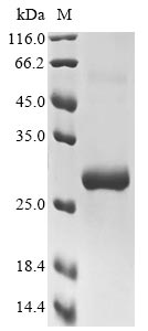 Greater than 90% as determined by SDS-PAGE.Recombinant Mouse Toll-Like Receptor 11 (TLR11) Protein (His&Myc)