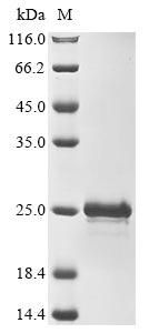 Greater than 85% as determined by SDS-PAGE.Recombinant Mouse Thymosin Beta-10 (TMSB10) Protein (His-SUMO)