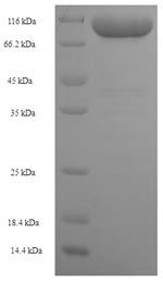 Greater than 90% as determined by SDS-PAGE.Recombinant Human Keratin, Type Ii Cytoskeletal 1B (KRT77) Protein (His-SUMO)