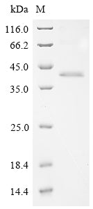 Greater than 85% as determined by SDS-PAGE.Recombinant Human Adhesion G-Protein Coupled Receptor G6 (ADGRG6) Protein (His)