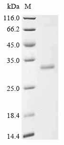 Greater than 85% as determined by SDS-PAGE.Recombinant Human Dipeptidyl Peptidase 9 (DPP9) Protein (His)