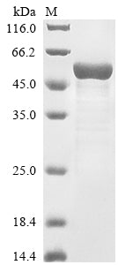 Greater than 85% as determined by SDS-PAGE.Recombinant Mouse Carnosine N-Methyltransferase (CARNMT1) Protein (His-SUMO)