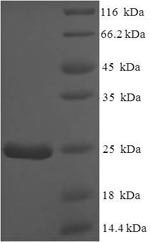 Greater than 90% as determined by SDS-PAGE.Recombinant Mouse Normal Mucosa Of Esophagus-Specific Gene 1 Protein (NMES1) Protein (His-SUMO)
