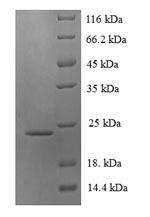 Greater than 90% as determined by SDS-PAGE.Recombinant Pan Troglodytes Lymphotoxin-Beta (LTB) Protein (His)
