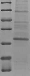 Greater than 90% as determined by SDS-PAGE.Recombinant Human Protein S100-A7A (S100A7A) Protein (His-SUMO)
