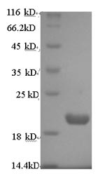 Greater than 90% as determined by SDS-PAGE.