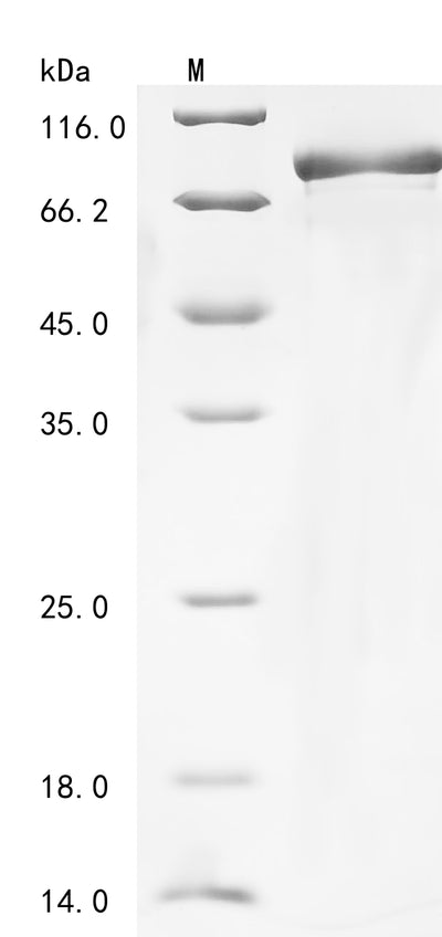 Greater than 85% as determined by SDS-PAGE.Recombinant Human Mitochondrial Antiviral-Signaling Protein (MAVS) Protein (His-SUMO)
